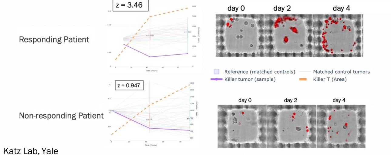 Z-score killer clone abundance — responder vs non-responder